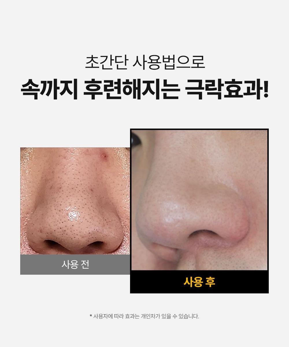 SUNGBOON EDITOR Blackhead Melting Clear Pad