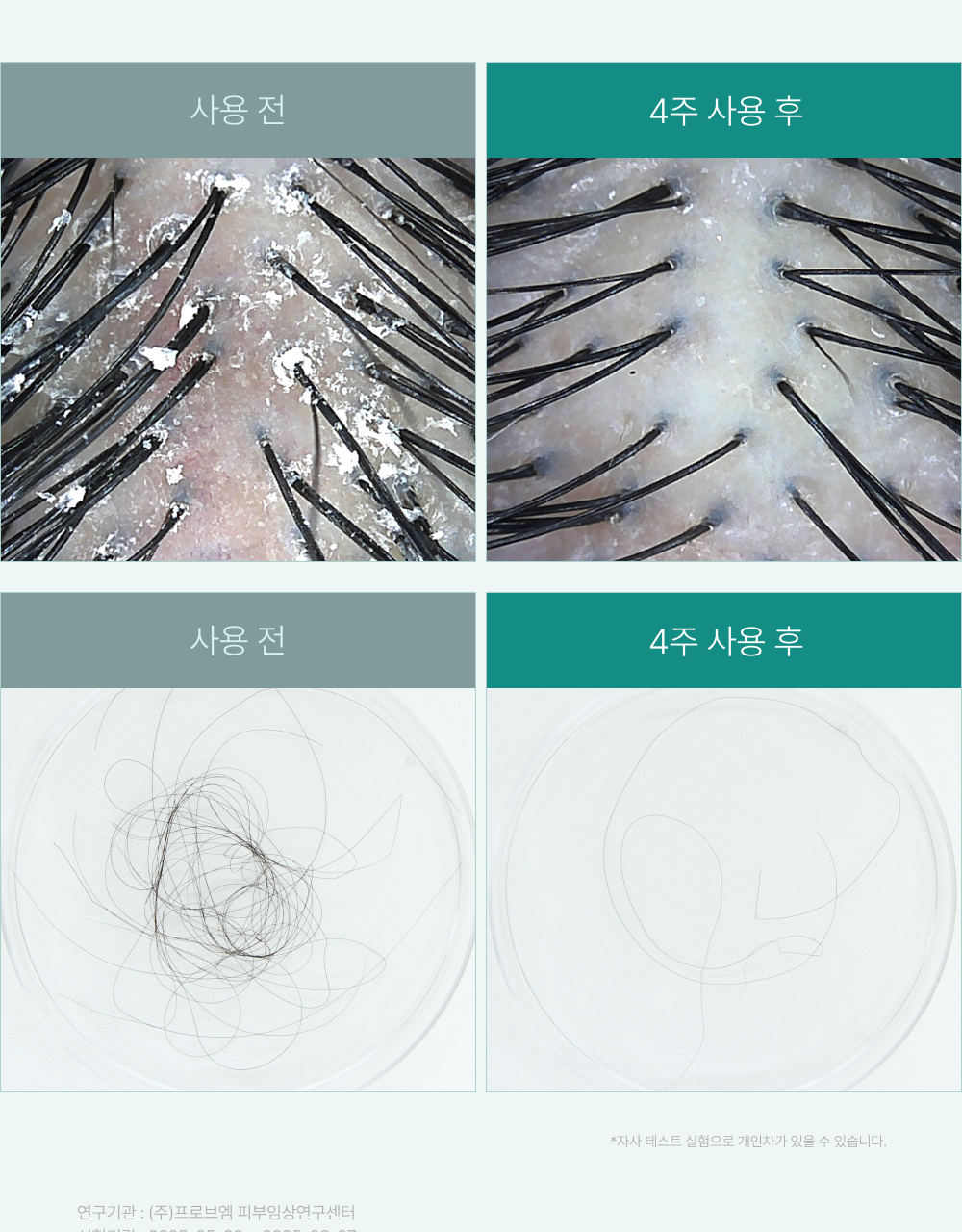 lilyeve Scalp Turn Cica PDRN Brush Ampoule