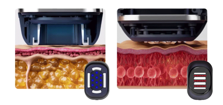 HOMEMODE - Therma Lift Beauty Device (+3 Skin Booster Ampoules)