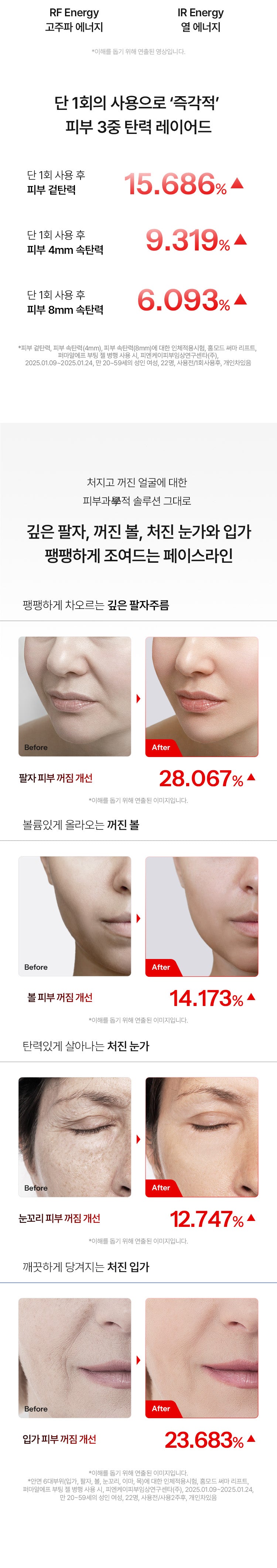 HOMEMODE - Therma Lift Beauty Device (+3 Skin Booster Ampoules)