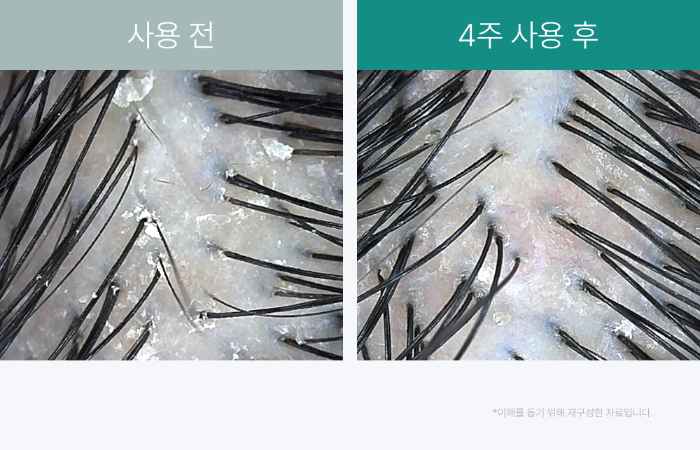 lilyeve Scalp Turn Cica PDRN Brush Ampoule