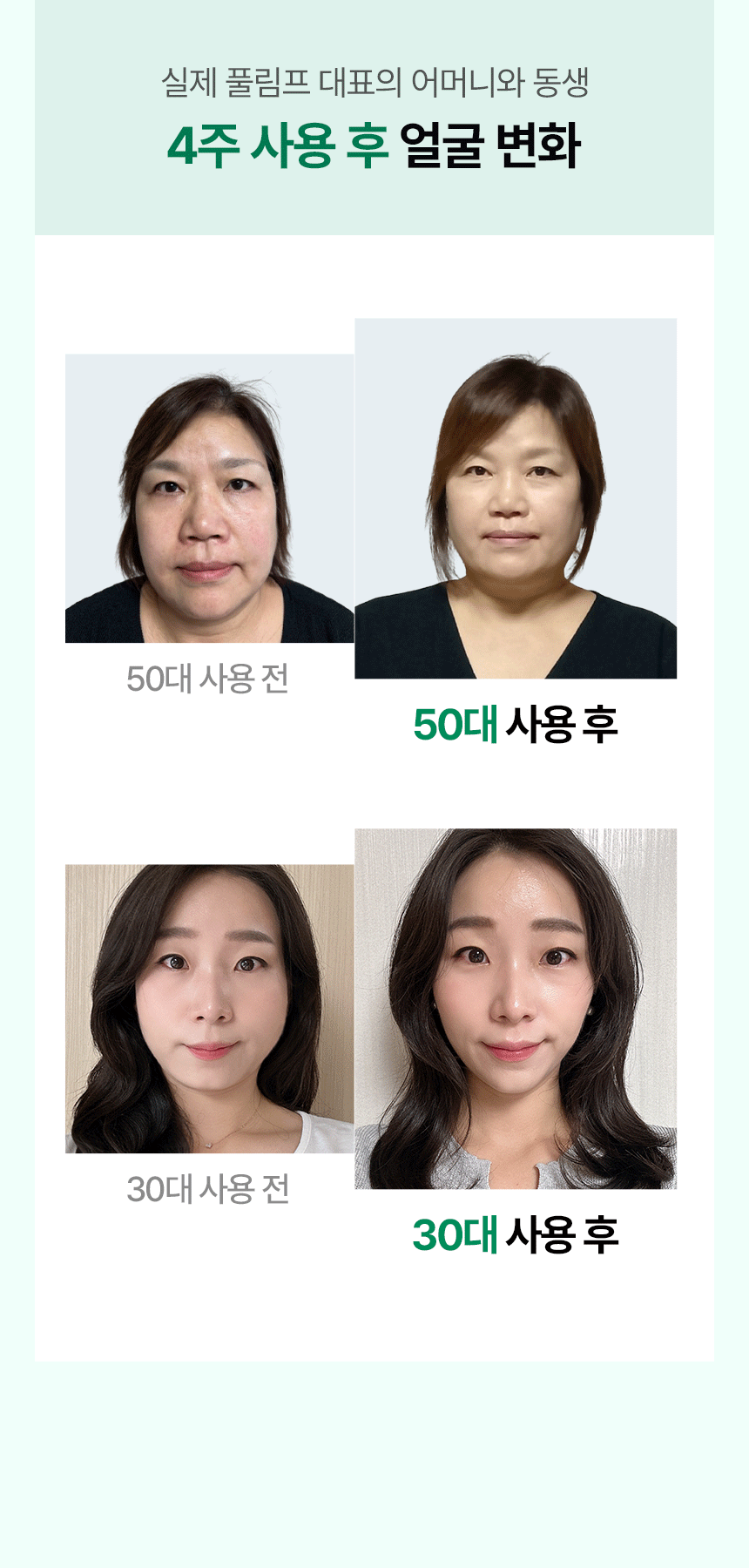 pulymph - EMS Face & Neck Lymphatic Massager (Lymphatic Drainage & V-Line Firming)