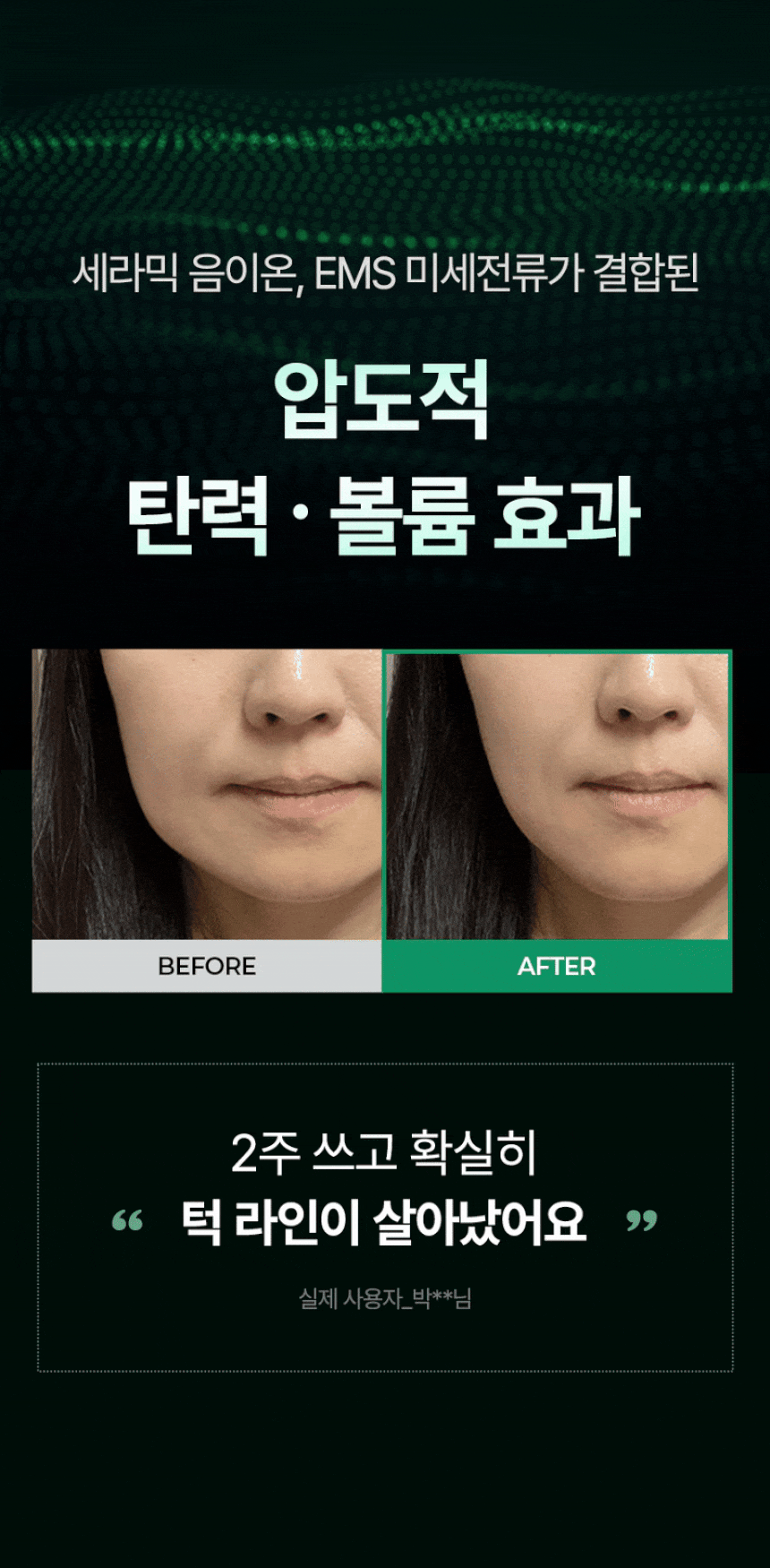 pulymph - EMS Face & Neck Lymphatic Massager (Lymphatic Drainage & V-Line Firming)