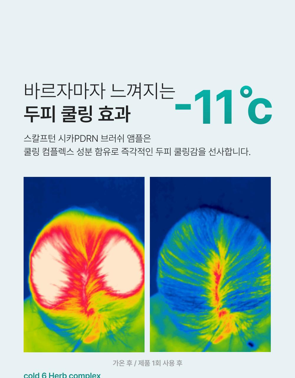 lilyeve Scalp Turn Cica PDRN Brush Ampoule