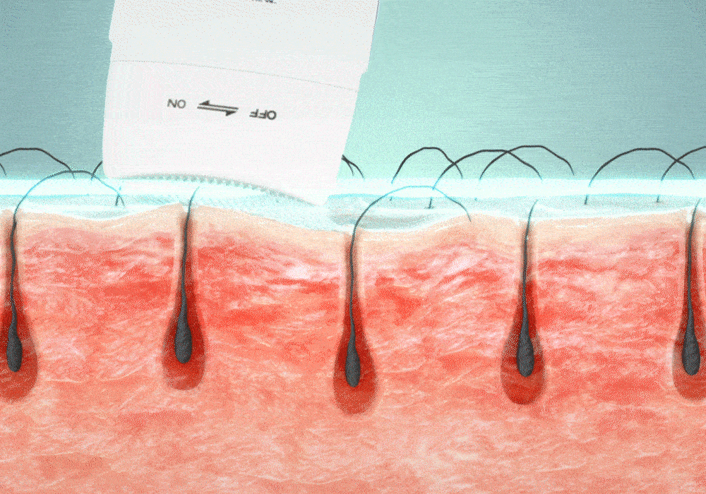 lilyeve Grow Turn Ampoule (Hair Loss Brush Ampoule)