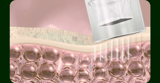 VUDE - Ultra-Low Molecular Diva Shot (Pore Care Beauty Device)