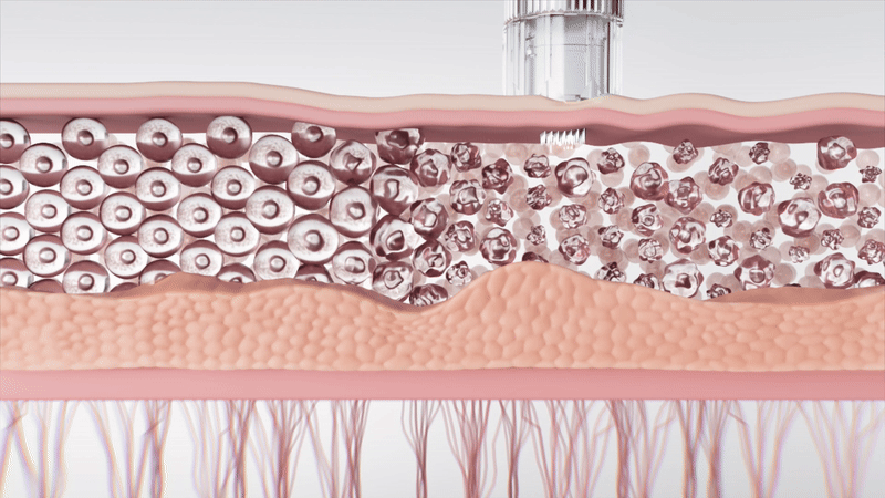 INJECTIER - Auto MTS Dual Ampoule Tip Inject Shot