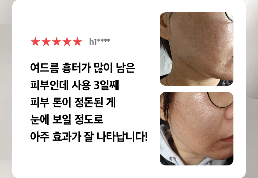 Quadthera - White Edition