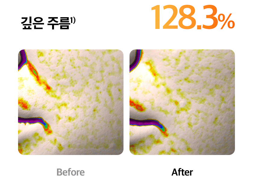 Quadthera - White Edition