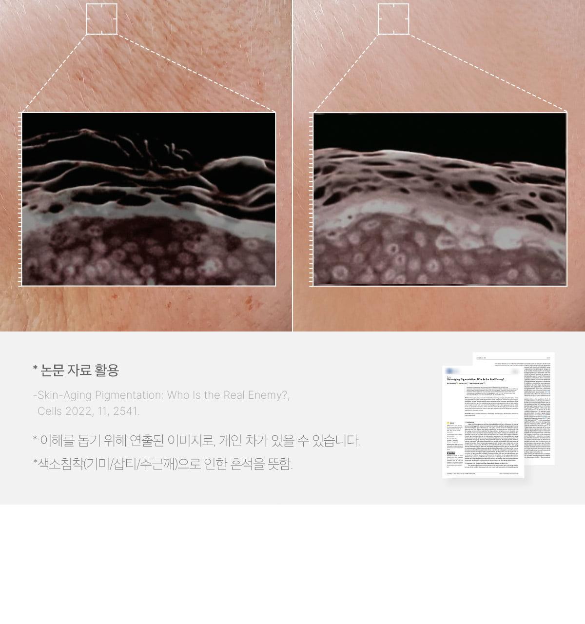 MEDICUBE Pore Pink Peptide Serum 30ml (1+1)