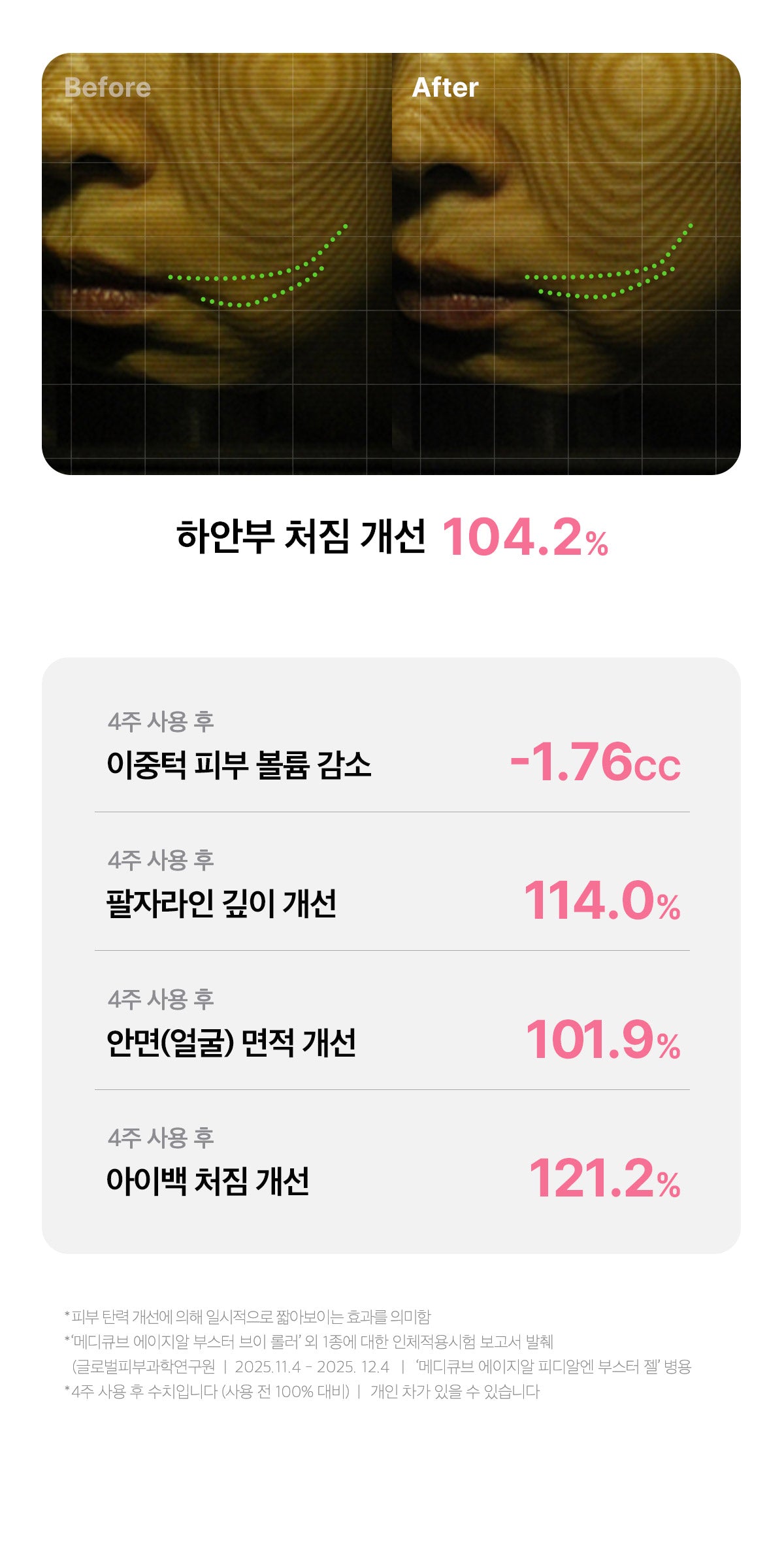 MEDICUBE AGE-R BOOSTER V ROLLER (BEAUTY DEVICE)