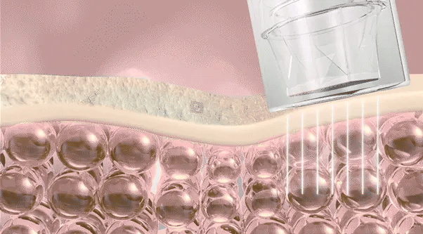 VUDE - Ultra-Low Molecular Diva Shot (Pore Care Beauty Device)