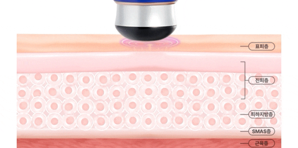 OLLIVIA - The Orlier S1 Beauty Device (Facial Contour & Lifting Care)