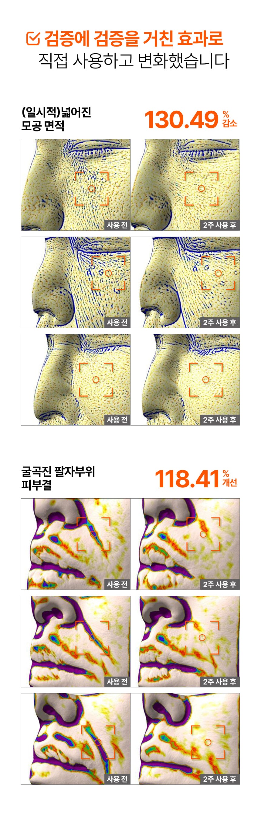 INJECTIER - Auto MTS Dual Ampoule Tip Inject Shot