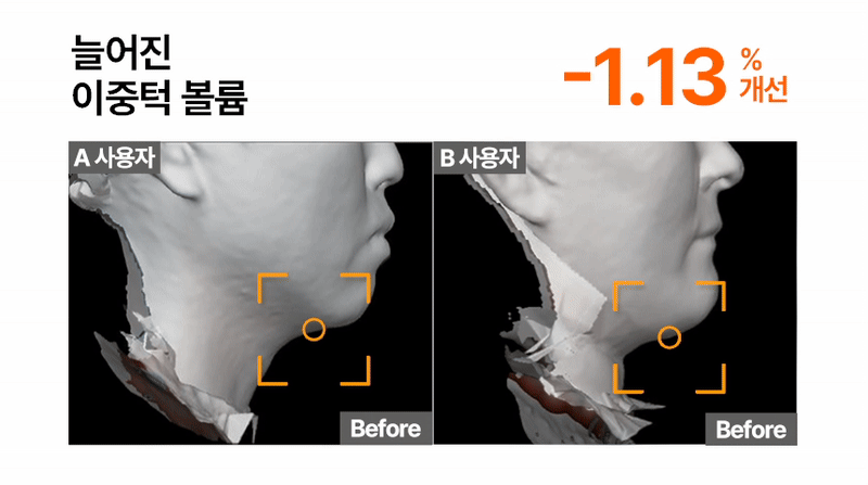 INJECTIER - Auto MTS Dual Ampoule Tip Inject Shot