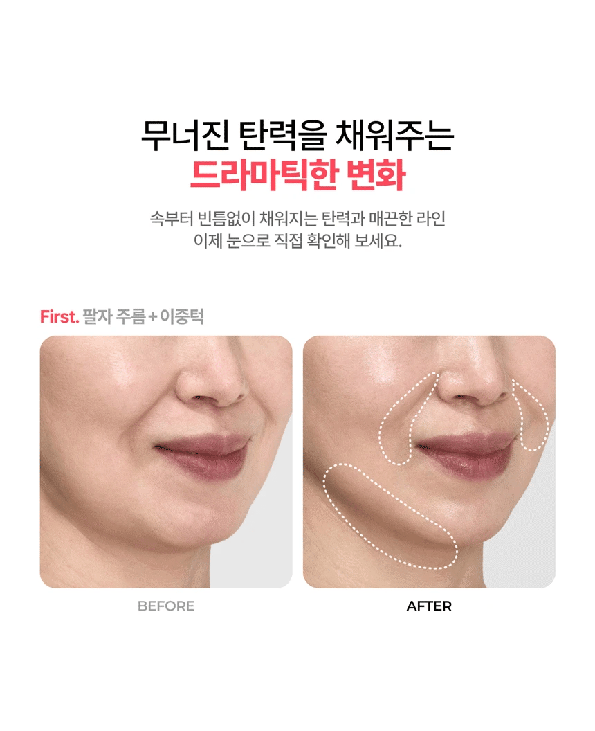 VOLEXY - BodyShot Pro Device