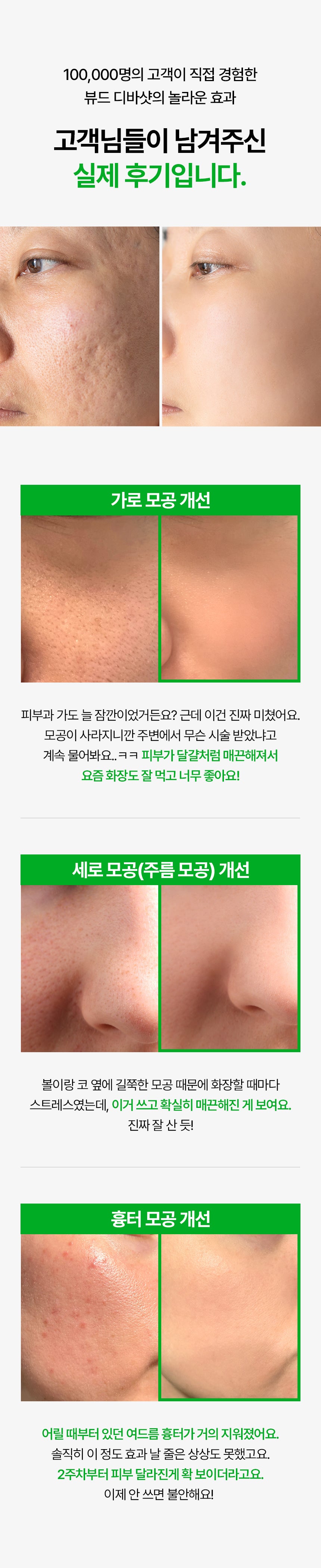 VUDE - Ultra-Low Molecular Diva Shot (Pore Care Beauty Device)