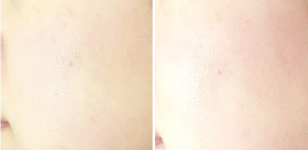 Genabelle PDRN Vita Toning Ampoule