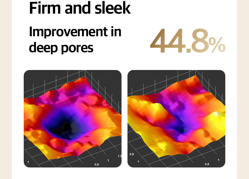 Quadthera TITAN Lifting Beauty Device