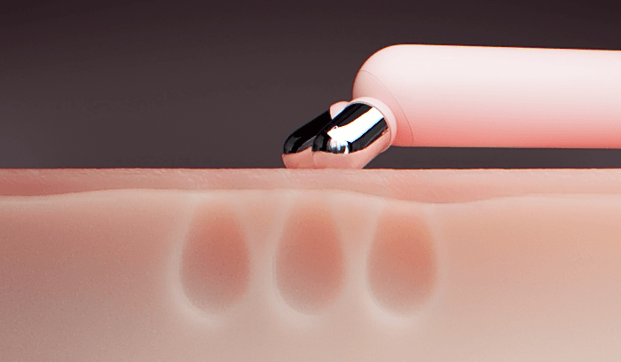 MEDICUBE AGE-R BOOSTER V ROLLER (BEAUTY DEVICE)