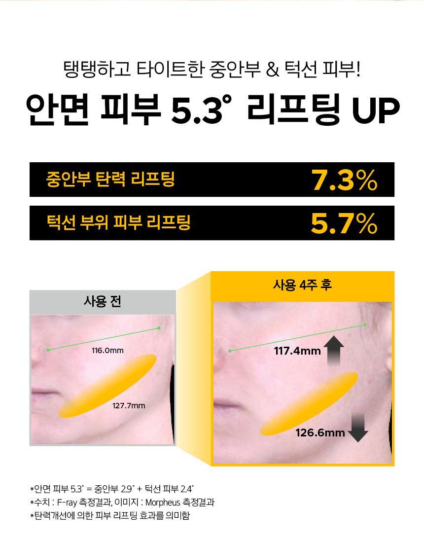 prmr - Vitatinol Serum Mega-Shot Gel Mask (4+1 Sheets)