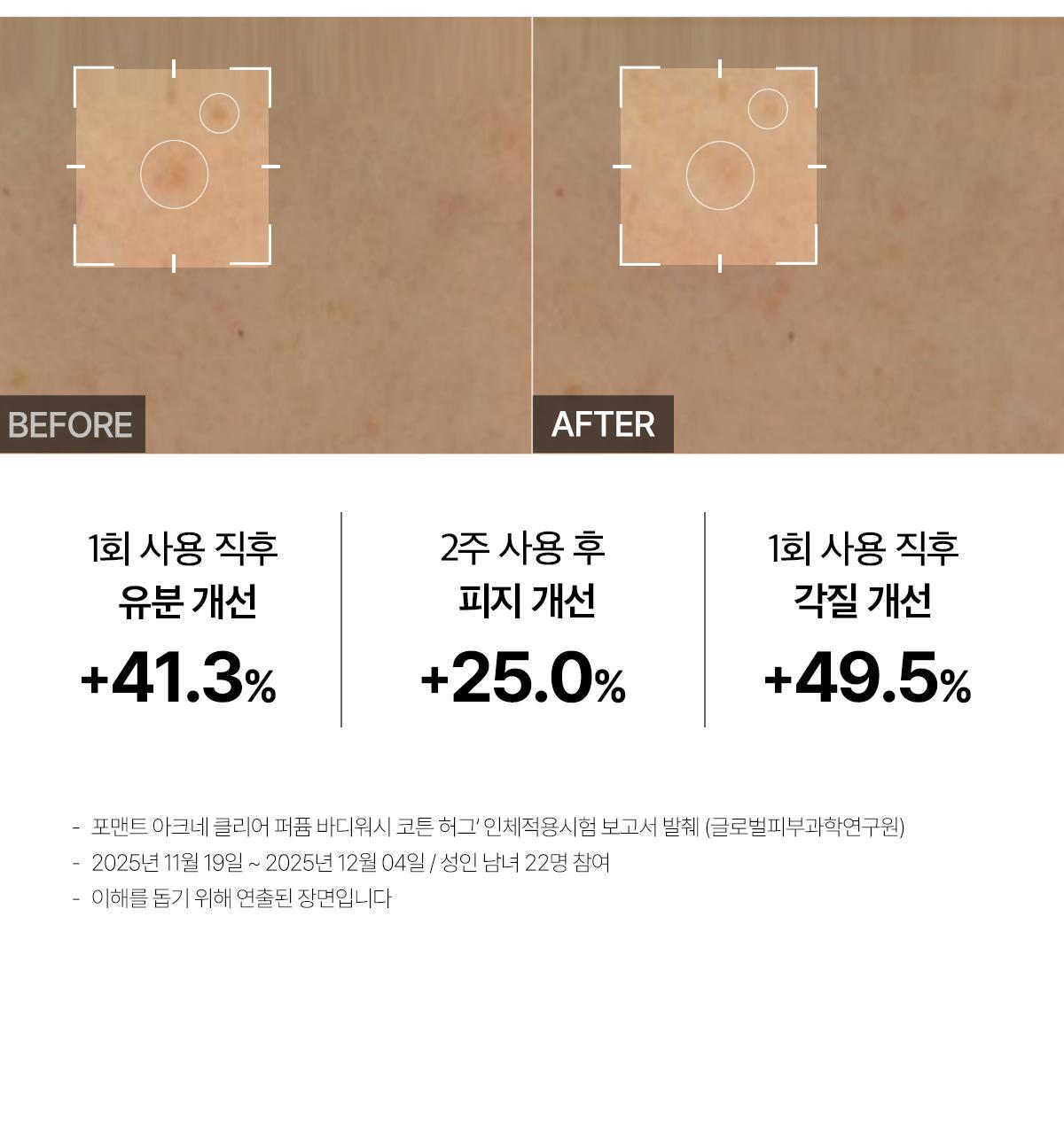 FORMENT - Acne Clear Perfume Body Wash 500ml (PARK JIHOON's Pick)