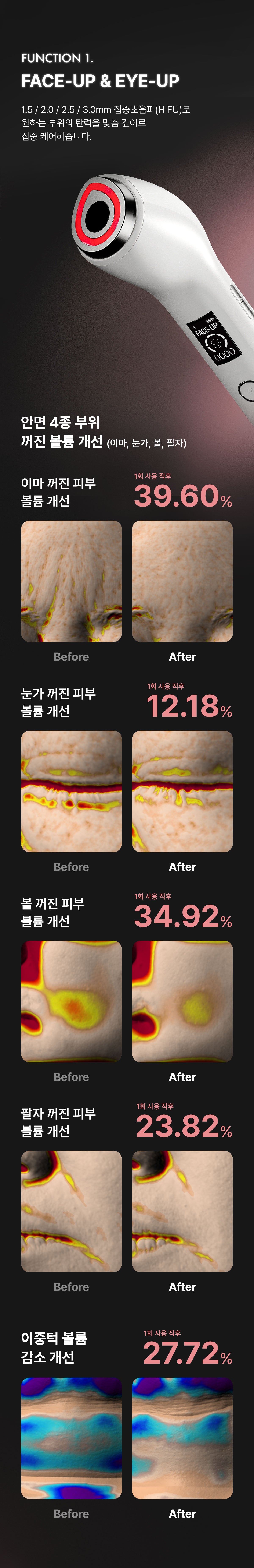 Glow.M - Hyper Glow Shot