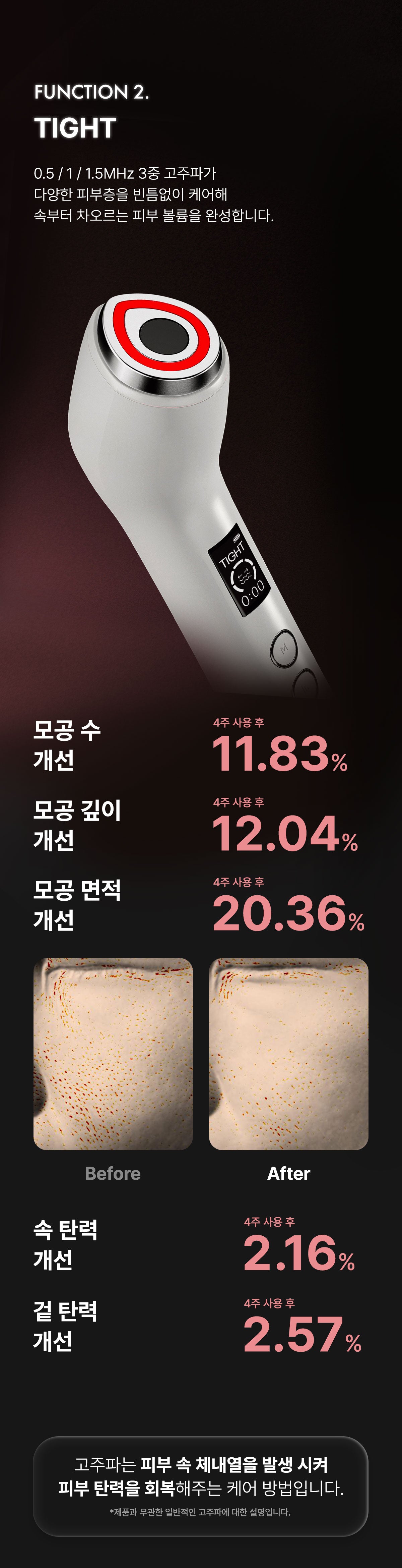 Glow.M - Hyper Glow Shot