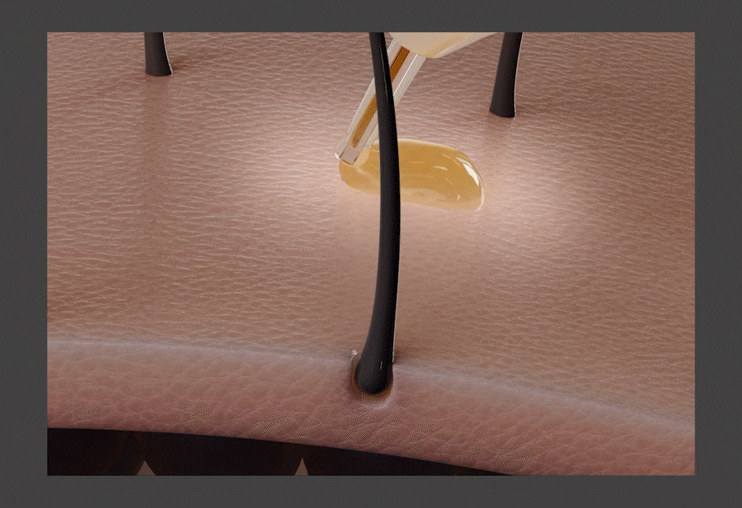 resnovae Hyper Shot (Advanced Scalp & Hair Care Device)