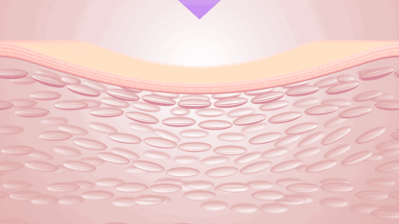 BIO HEAL BOH - Probioderm Collagen Remodeling Cream 50ml (+ Serum 13ml)