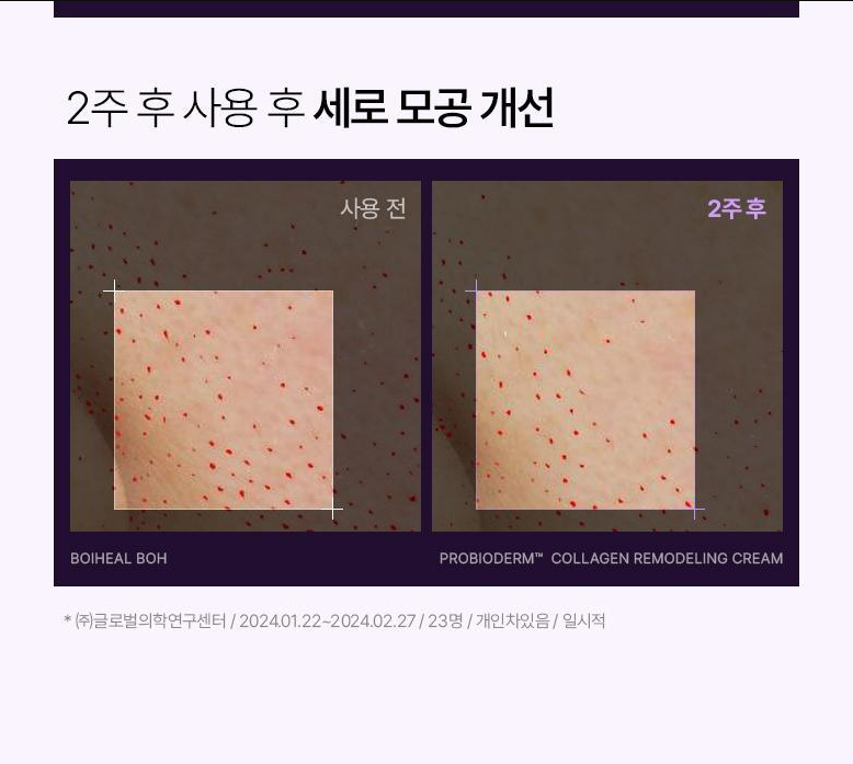 BIO HEAL BOH - Probioderm Collagen Remodeling Cream 50ml (+ Serum 13ml)