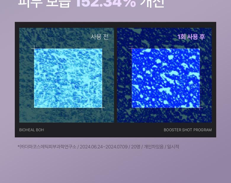 BIO HEAL BOH - Probioderm Collagen Remodeling Booster Shot Program