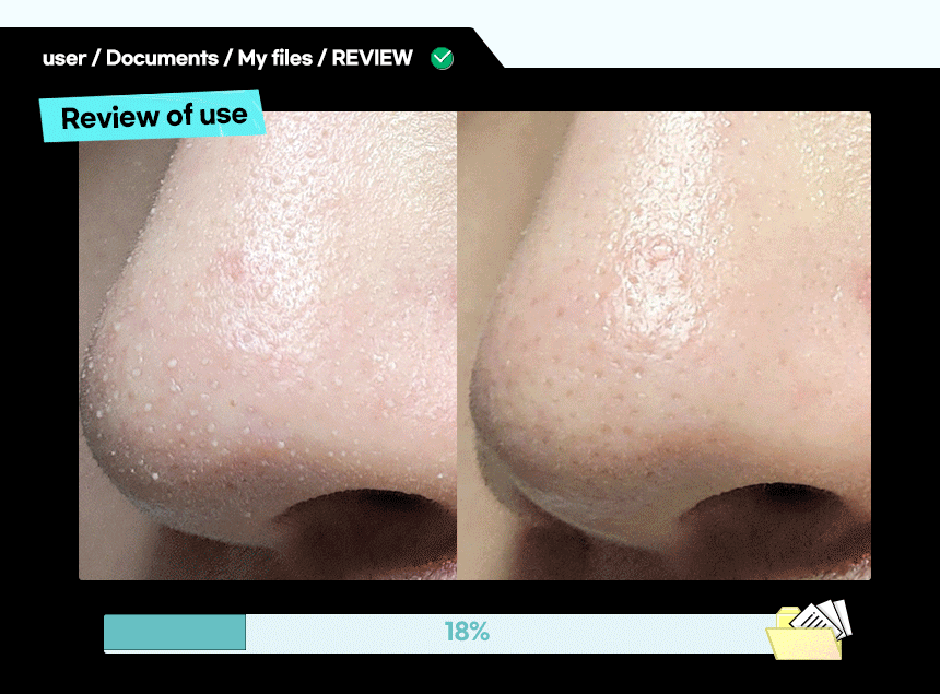 ilso Super Melting Sebum Softener 150ml (+40 Cotton Pads)