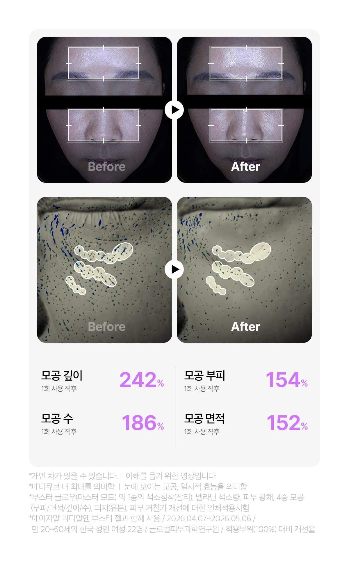 Medicube - AGE-R Booster Glow (Beauty Device)