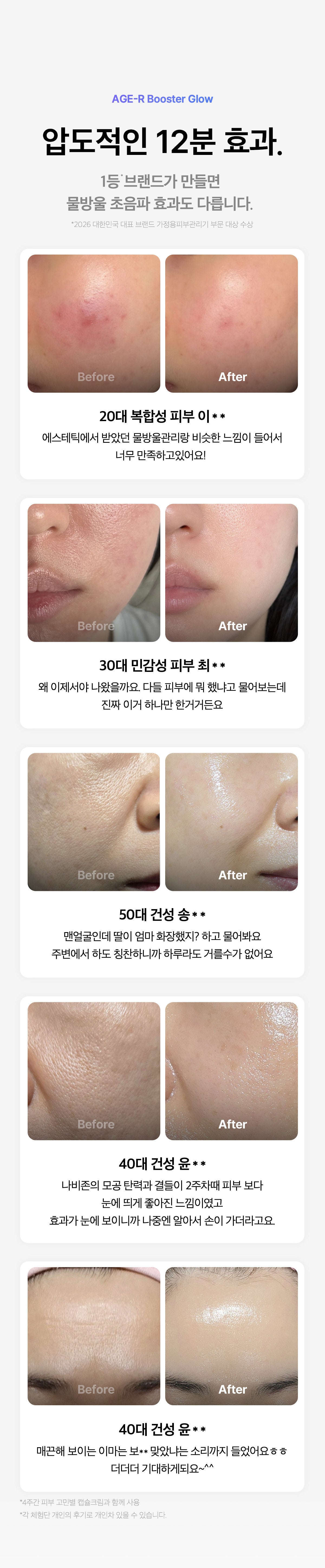 Medicube - AGE-R Booster Glow (Beauty Device)