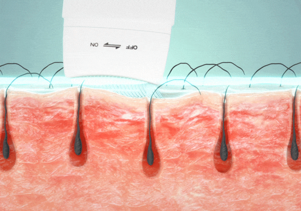 lilyeve Grow Turn Ampoule (Hair Loss Brush Ampoule)