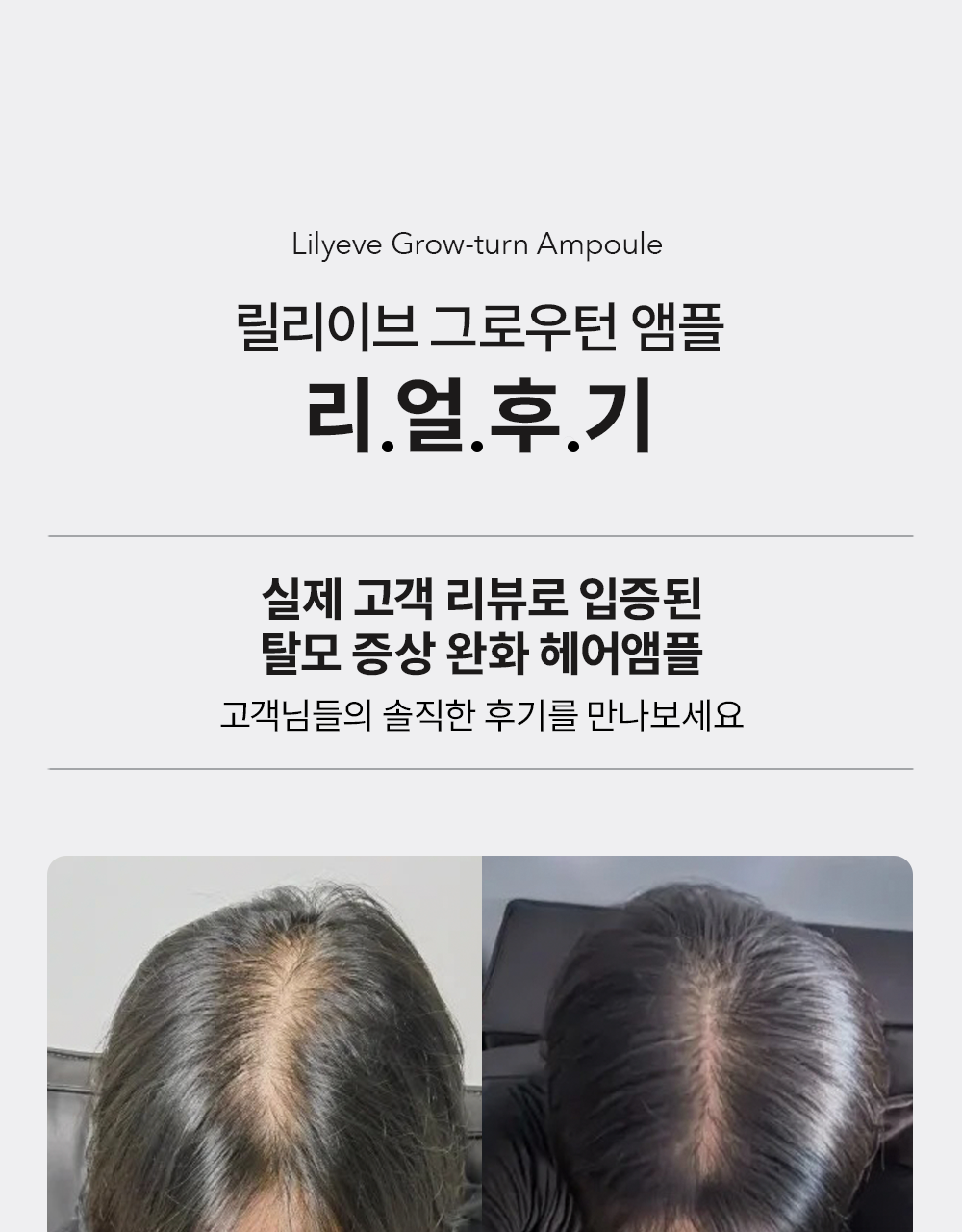 lilyeve Grow Turn Ampoule (Hair Loss Brush Ampoule)