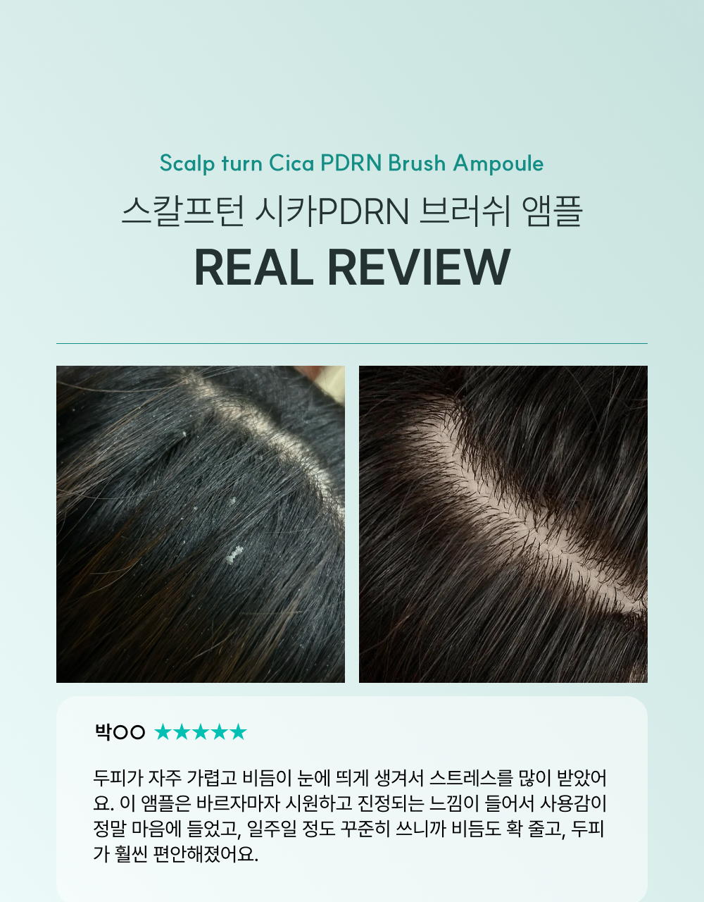 lilyeve Scalp Turn Cica PDRN Brush Ampoule