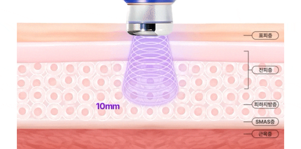 OLLIVIA - The Orlier S1 Beauty Device (Facial Contour & Lifting Care)