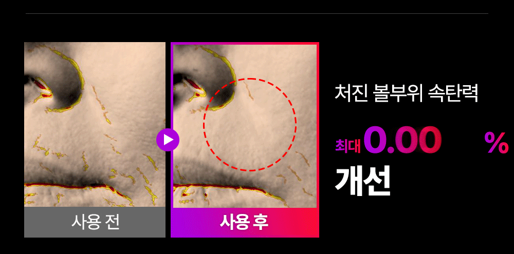 MOMMYCARE - EMS V-THERA Lifting Beauty Device (Teenieping Edition)