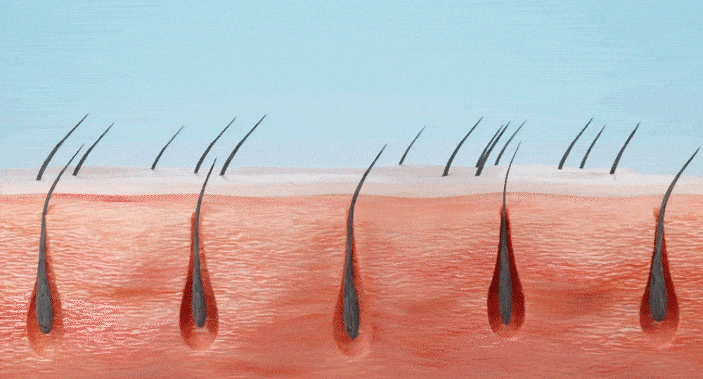 lilyeve Scalp Turn Cica PDRN Brush Ampoule