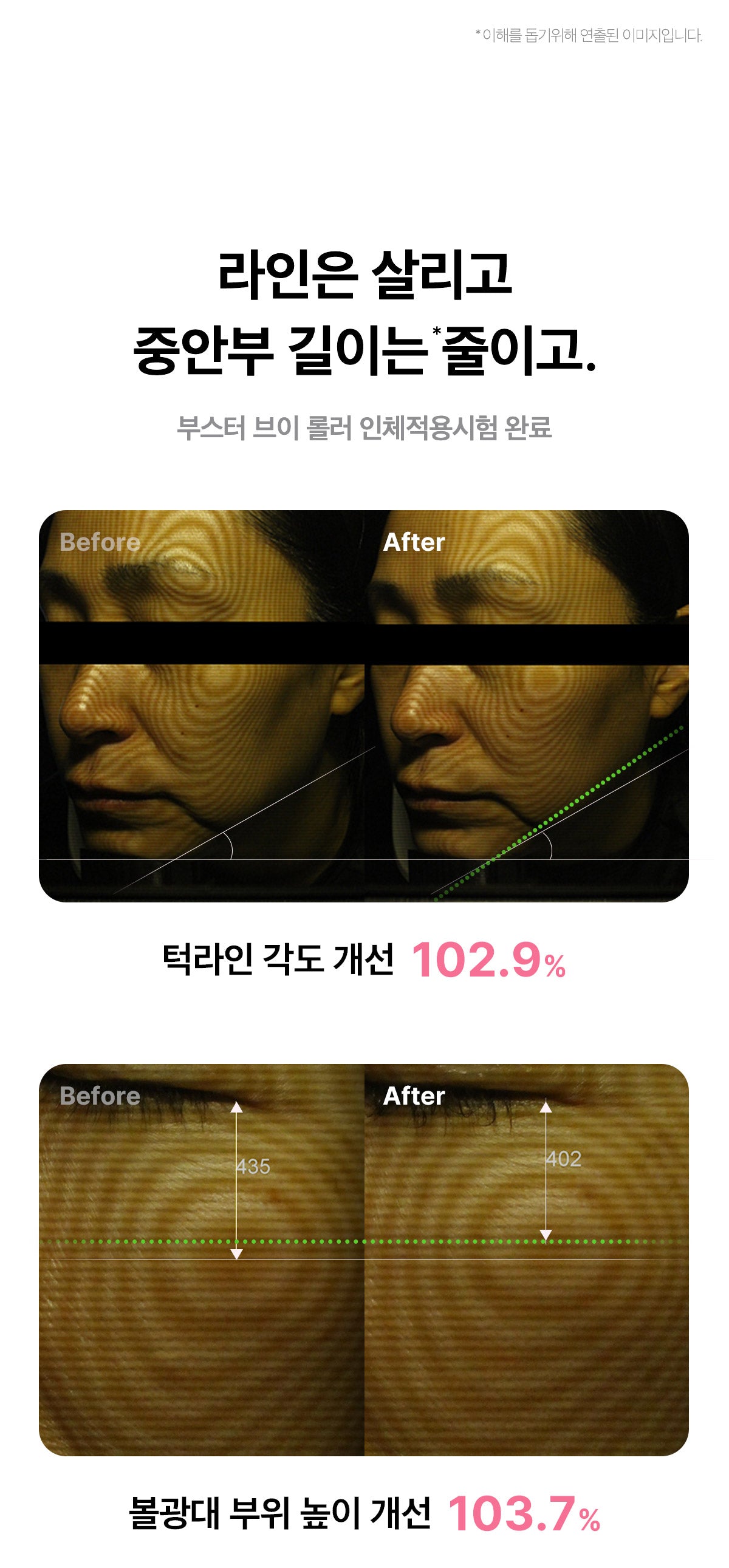 MEDICUBE AGE-R BOOSTER V ROLLER (BEAUTY DEVICE)