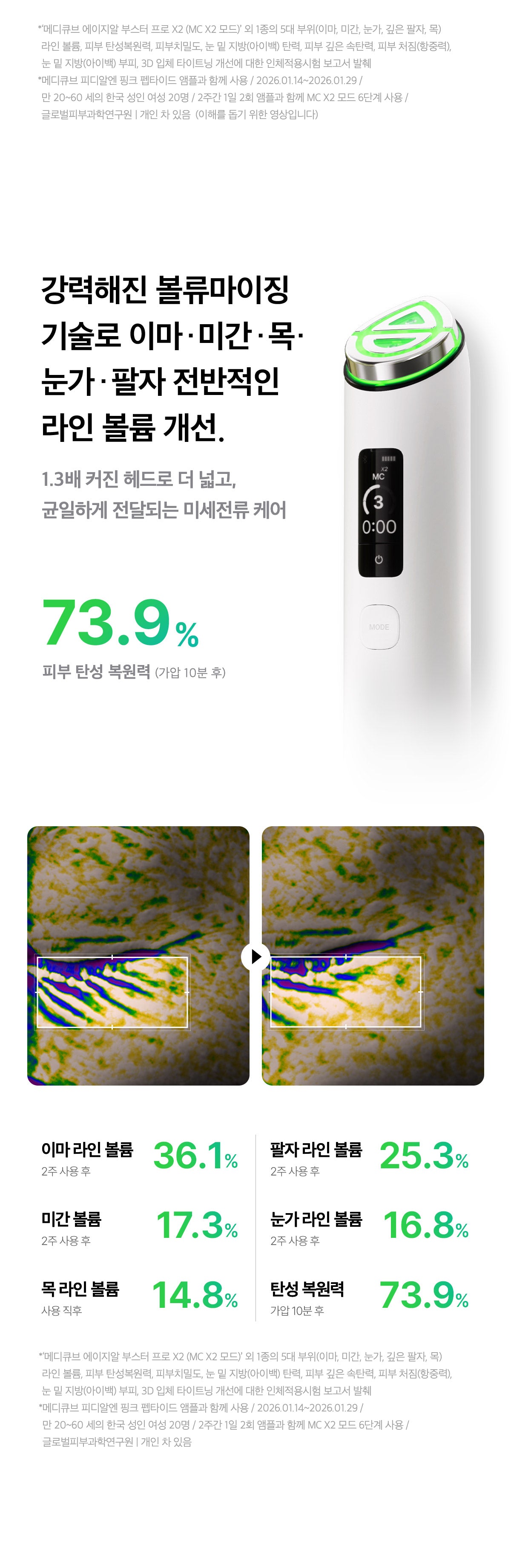 Medicube - AGE-R Booster Pro X2 ZO&FRIENDS Edition (Beauty Device)