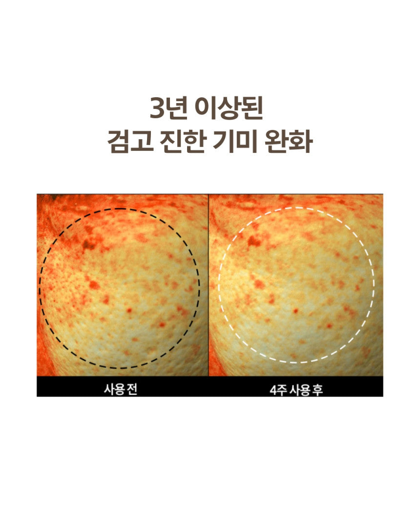 DOMINAS - Dark Spot & Melasma Cream (Tranexamic Acid) [K-Pharmacy Item]