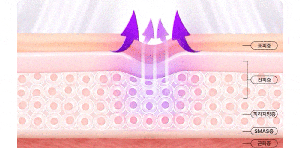 OLLIVIA - The Orlier S1 Beauty Device (Facial Contour & Lifting Care)