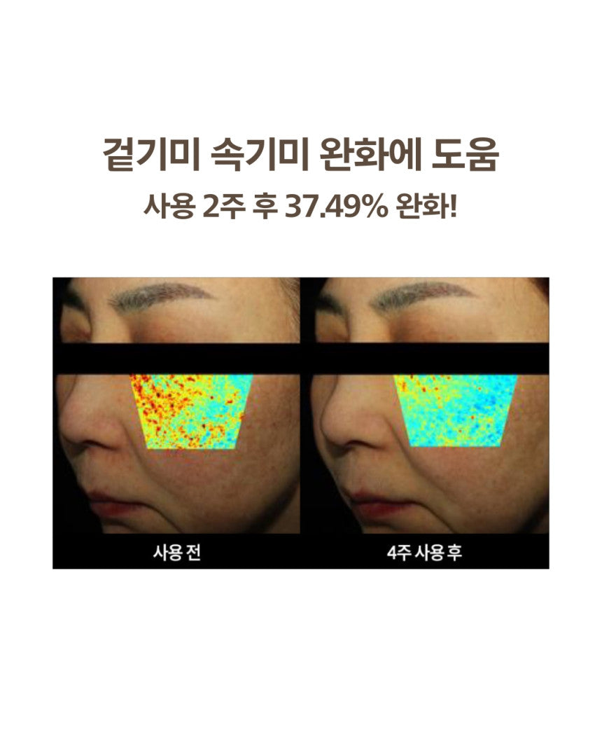 DOMINAS - Dark Spot & Melasma Cream (Tranexamic Acid) [K-Pharmacy Item]