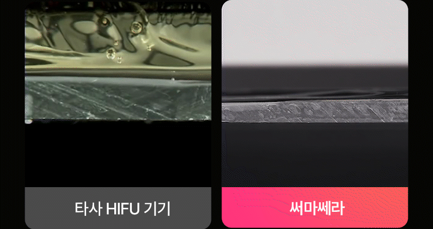 THERMATHERA - Unlimited-Shot HIFU Beauty Device [New Launch!]