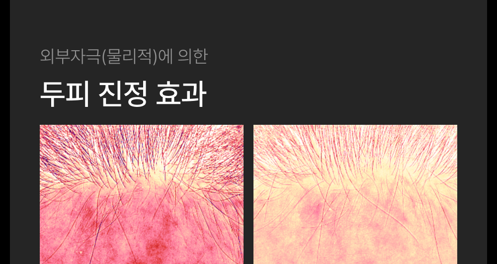 [lilyeve] - GrowTurn Brush Steam Booster