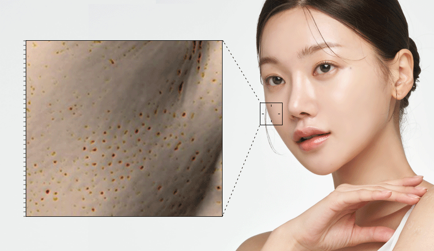 THERMATHERA - Unlimited-Shot HIFU Beauty Device [New Launch!]