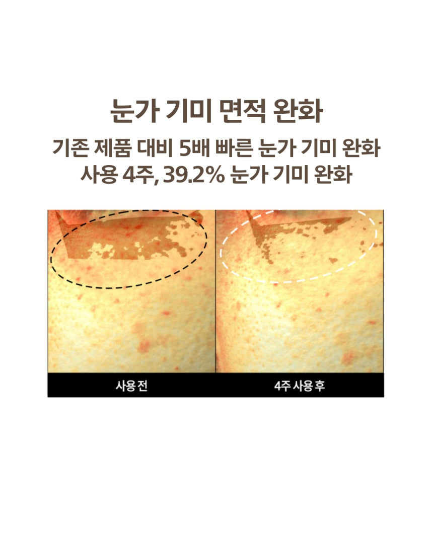 DOMINAS - Dark Spot & Melasma Cream (Tranexamic Acid) [K-Pharmacy Item]